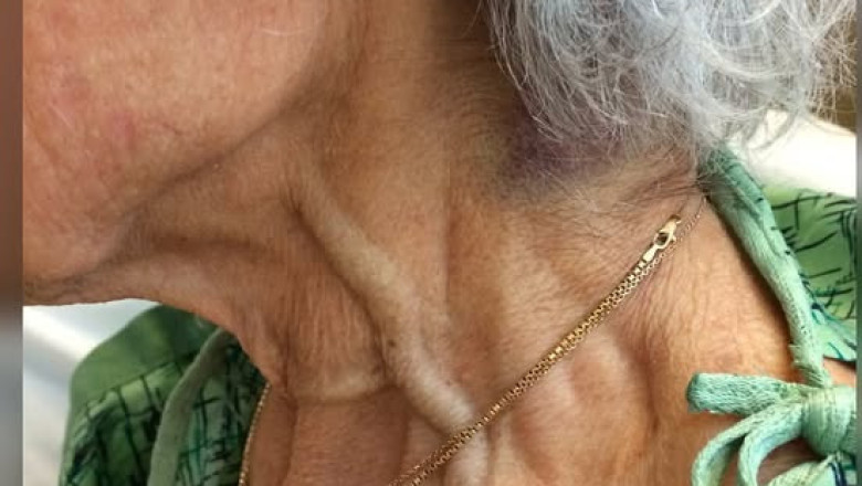 Patient Presents with Shortness of Breath: Neck Examination Findings and Diagnostic Pathways